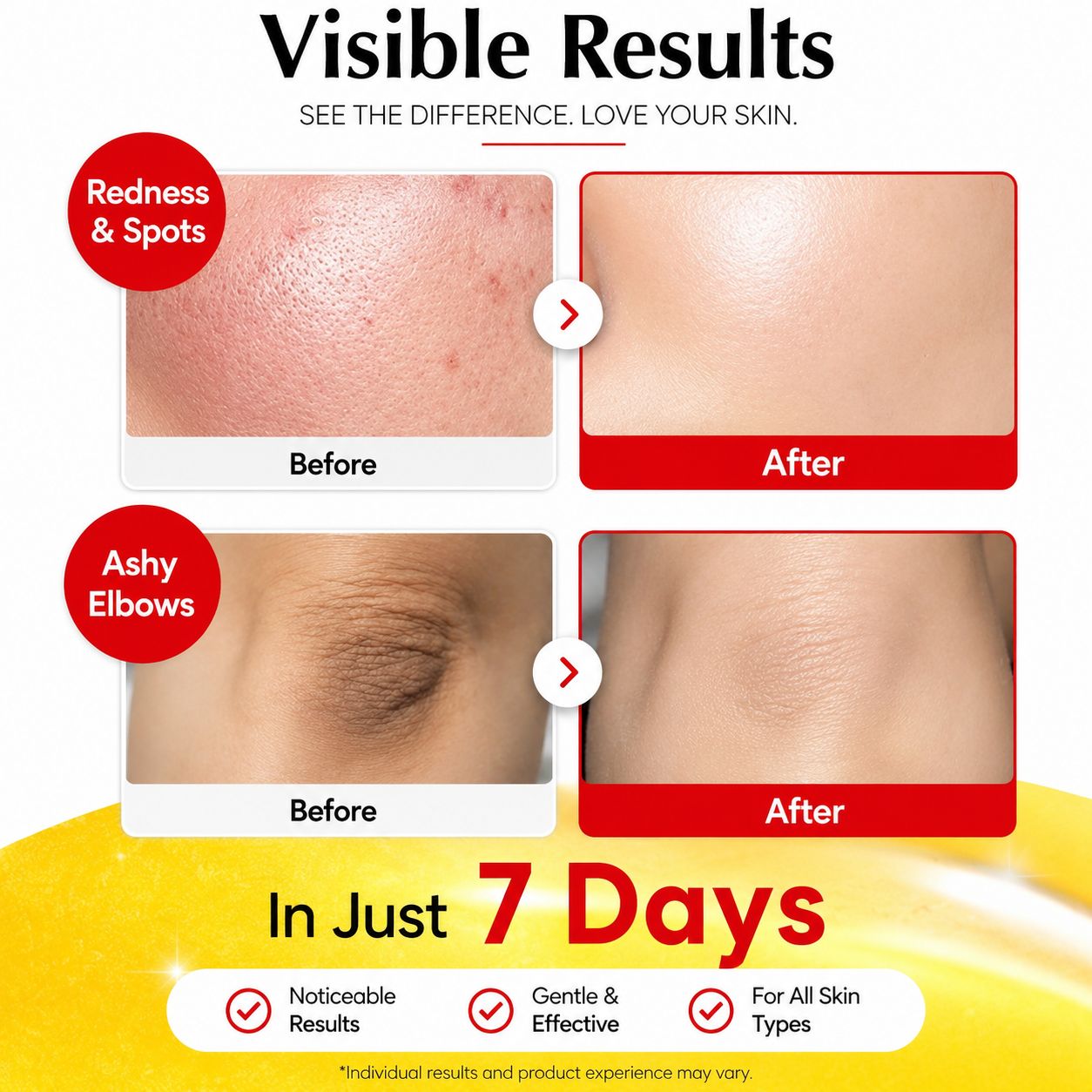 EqualBerry Vitamin illuminating Serum